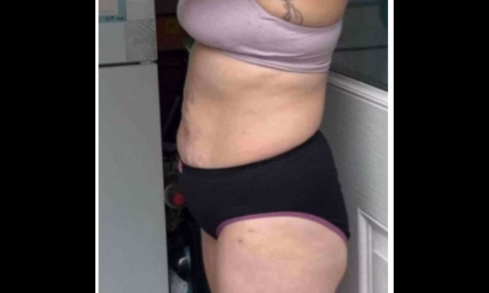 After Transformation 1