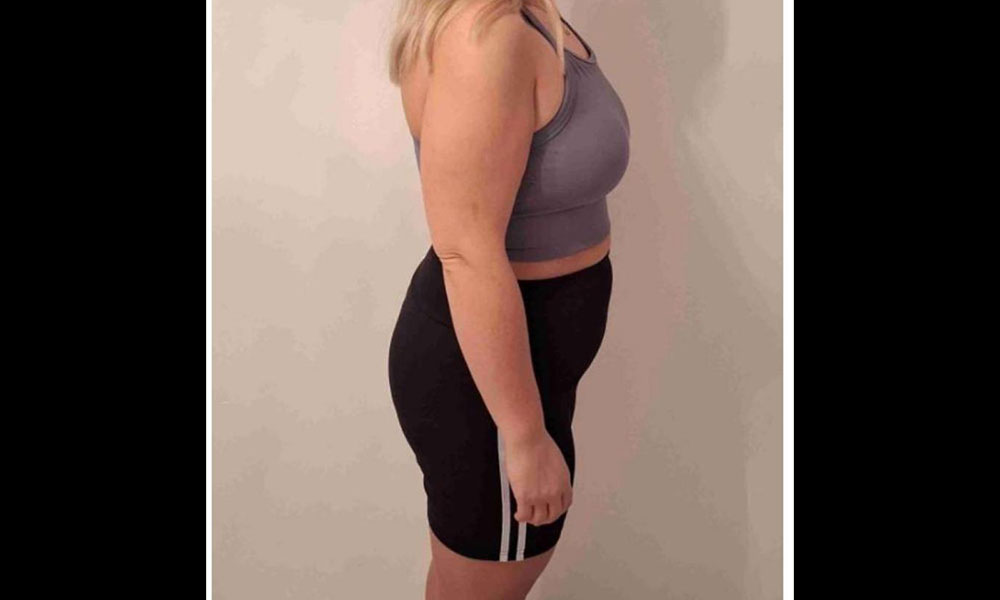 After Transformation 3