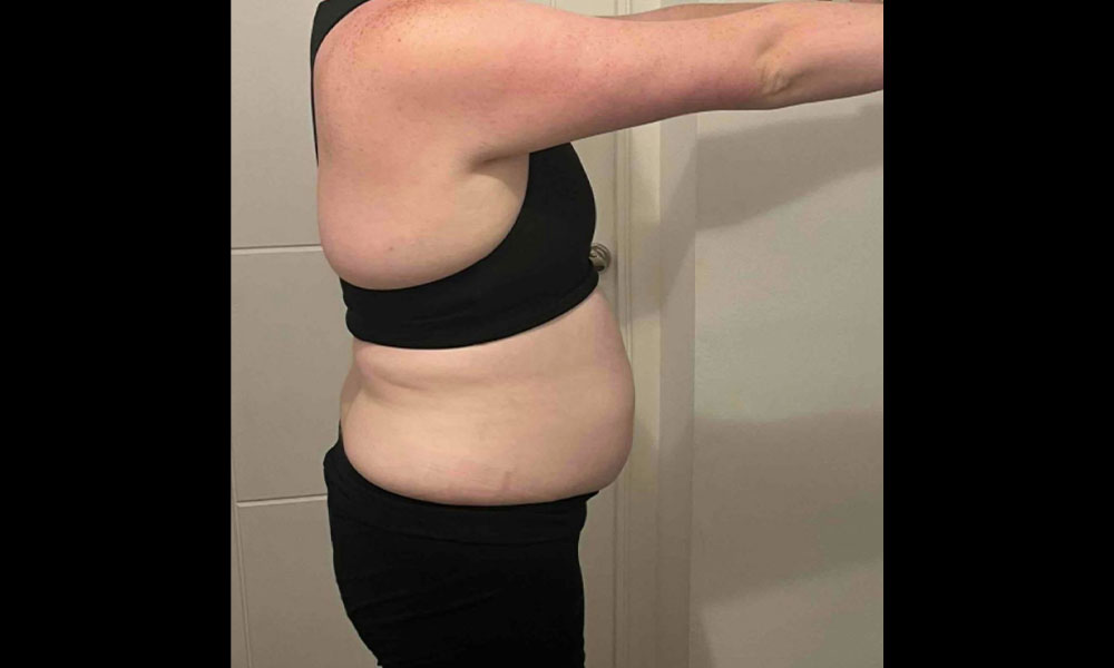 Before Transformation 2